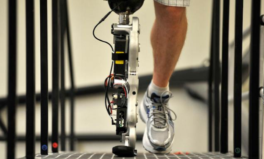 河南假肢淺談小腿假肢的功能及分類(圖1) 假肢
