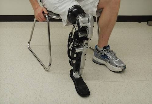 河南假肢淺談小腿假肢的功能及分類(圖2) 假肢